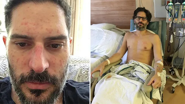 Joe Manganiello televizyon programında evliliği ve sağlık süreci hakkında açıklamalarda bulunuyor.