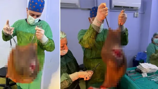 Aydın'da 67 yaşındaki bir kadının karnından 40 kilogramlık kitle çıkarılması ameliyatı.