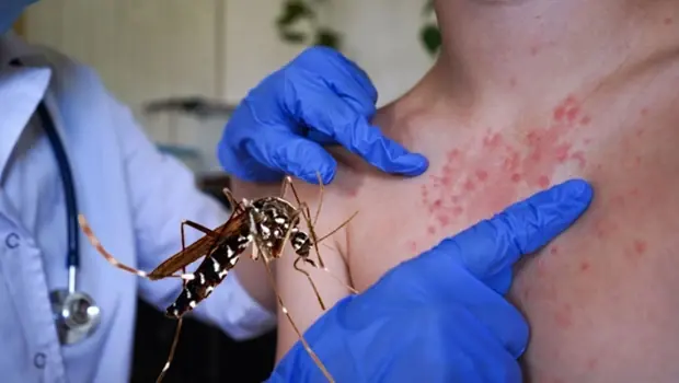 Chikungunya virüsünün yayılma riski altındaki dünya haritası, sivrisinek ve iklim değişikliği unsurlarıyla.